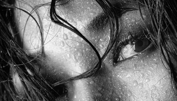 Beauchamp Aesthetics - Excessive Sweating