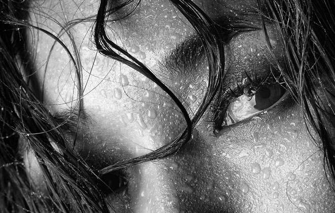 Beauchamp Aesthetics - Excessive Sweating