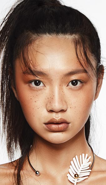 Beauchamp Aesthetics - Pigmentation