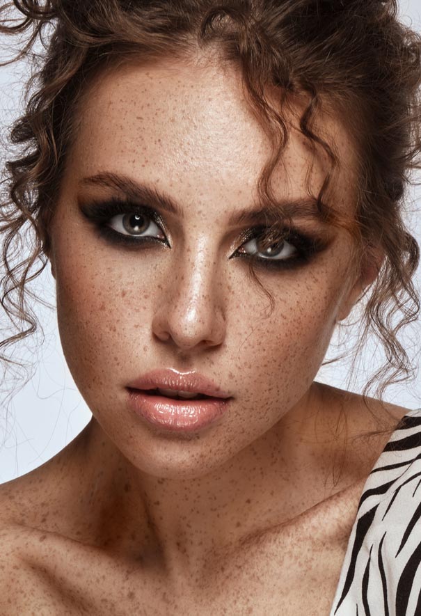 Beauchamp Aesthetics - Understanding Pigmentation