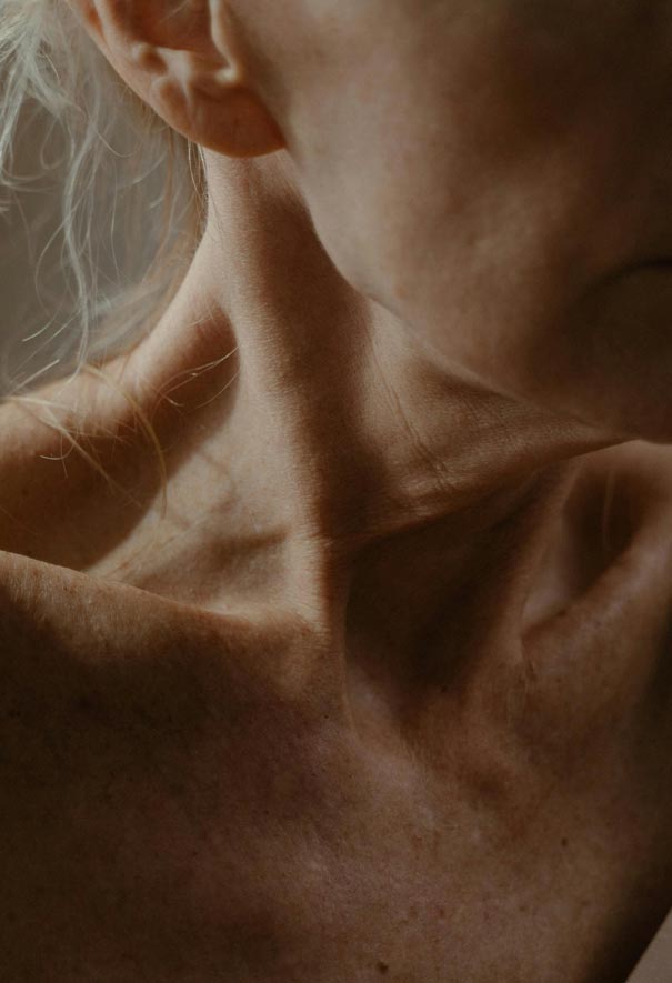 Beauchamp Aesthetics - Skin Laxity What Is?