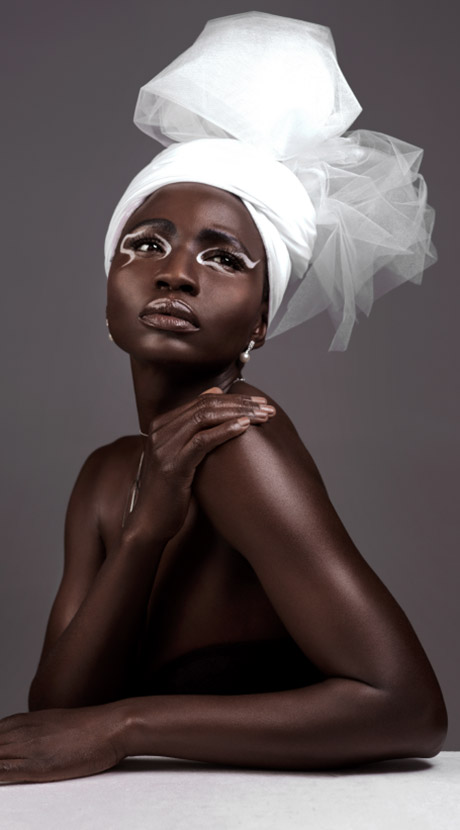 Beauchamp Aesthetics - What causes acne?