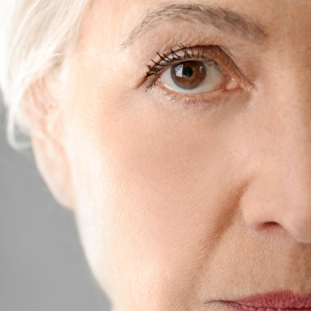 Beauchamp Aesthetics - Anti-Wrinkle Injections After