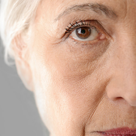 Beauchamp Aesthetics - Anti-Wrinkle Injections Before